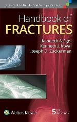 Handbook of Fractures