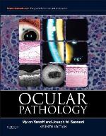 Ocular Pathology
