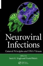 Neuroviral Infections