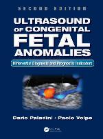 Ultrasound of Congenital Fetal Anomalies