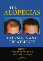 The Alopecias