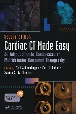 Cardiac CT made easy : an introduction to cardiovascular multidetector computed tomography