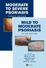 Mild to Moderate Psoriasis, Third Edition