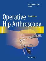 Operative Hip Arthroscopy