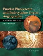 Fundus Fluorescein and Indocyanine Green Angiography