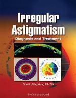Irregular Astigmatism