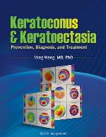Keratoconus and Keratoectasia