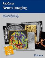 Neuro Imaging