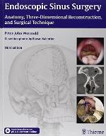 Endoscopic Sinus Surgery