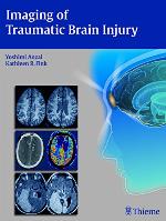 Imaging of traumatic brain injury
