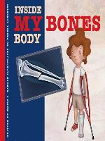 My Bones