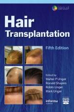 Hair Transplantation [with DVD]
