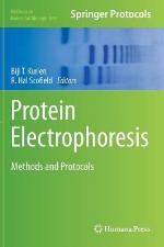 Protein Electrophoresis