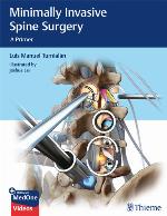 Minimally Invasive Spine Surgery