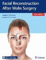 Facial Reconstruction After Mohs Surgery
