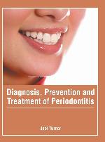 Diagnosis, Prevention and Treatment of Periodontitis
