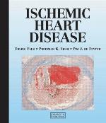 Ischemic Heart Disease