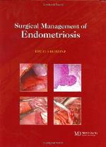 Surgical Management Of Endometriosis