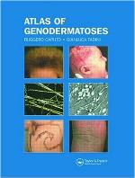 Atlas of Genodermatoses