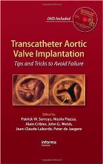 Transcatheter Aortic Valve Implantation