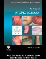 An Atlas of Atopic Eczema