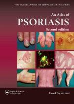 An Atlas of Psoriasis, Second Edition (Encyclopedia of Visual Medicine Series)