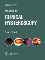Manual of Clinical Hysteroscopy, Second Edition