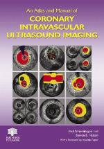 An Atlas and Manual of Coronary Intravascular Ultrasound Imaging