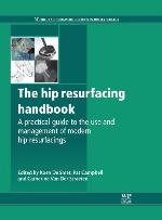 The hip resurfacing handbook