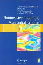 Noninvasive Imaging of Myocardial Ischemia