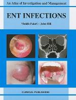 Ent Infections
