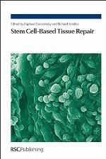 Stem Cell-Based Tissue Repair