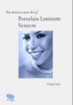 Science and Art of Porcelain Laminate Veneers