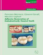 Adhesive Restoration of Endodontically Treated Teeth : QuintEssentials of Dental Practice Vol. 40.