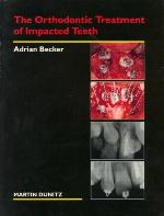 The Orthodontic Treatment of Impacted Teeth