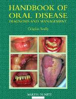 Handbook of Oral Disease