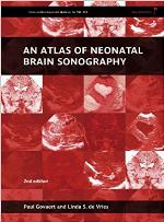 An Atlas of Neonatal Brain Sonography