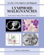 Lymphoid Malignancies