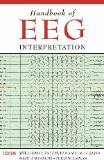 Handbook of EEG Interpretation