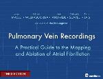 Pulmonary Vein Recordings