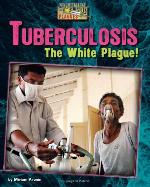 Tuberculosis