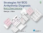 Strategies for ECG Arrhythmia Diagnosis