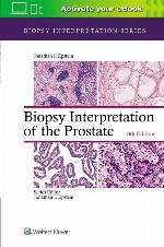 Biopsy Interpretation of the Prostate (Biopsy Interpretation Series)
