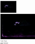 Couper le cordon : guérir de nos dépendances affectives