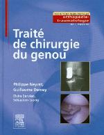 Trait� de Chirurgie Du Genou