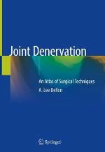 Joint Denervation