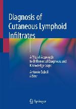 Diagnosis of cutaneous lymphoid infiltrates : a visual approach to differential diagnosis and knowledge gaps