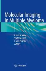 Molecular Imaging in Multiple Myeloma