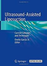 Ultrasound-Assisted Liposuction