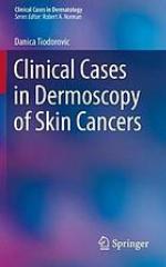 Clinical cases in dermoscopy of skin cancers